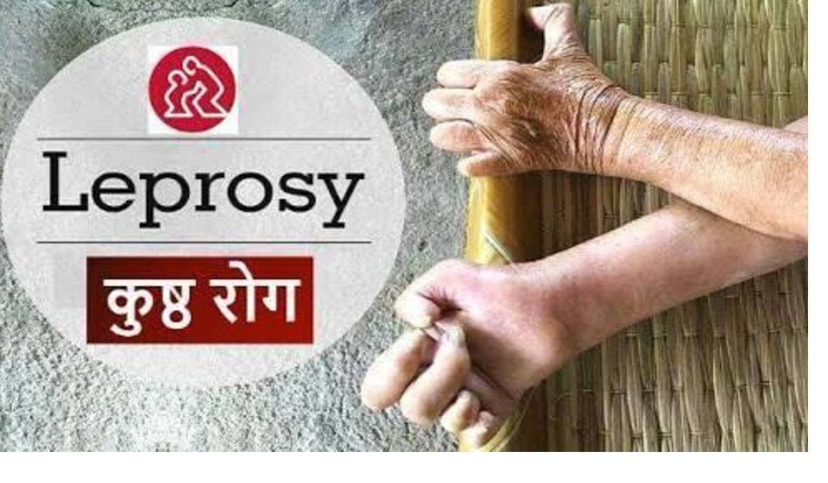 World Leprosy day