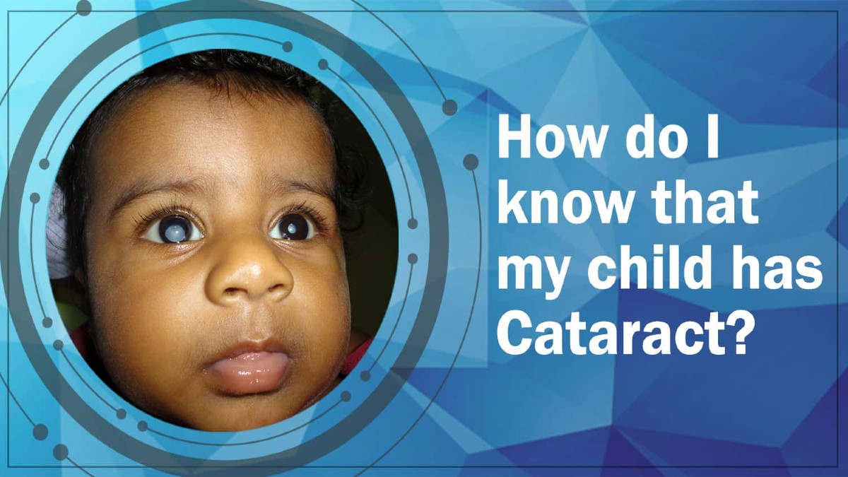 Cataract in children