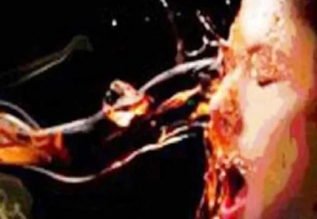 Acid attack: देवरिया में दो युवतियों पर एसिड अटैक, एक का चेहरा और दुसरी का हाथ झुलसा